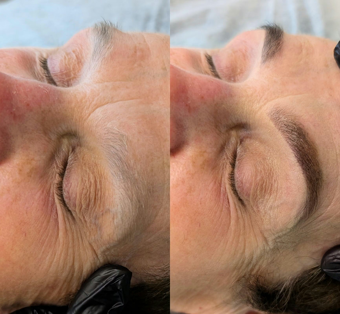 Before and after comparison of a person's face with visible skin texture and lines.