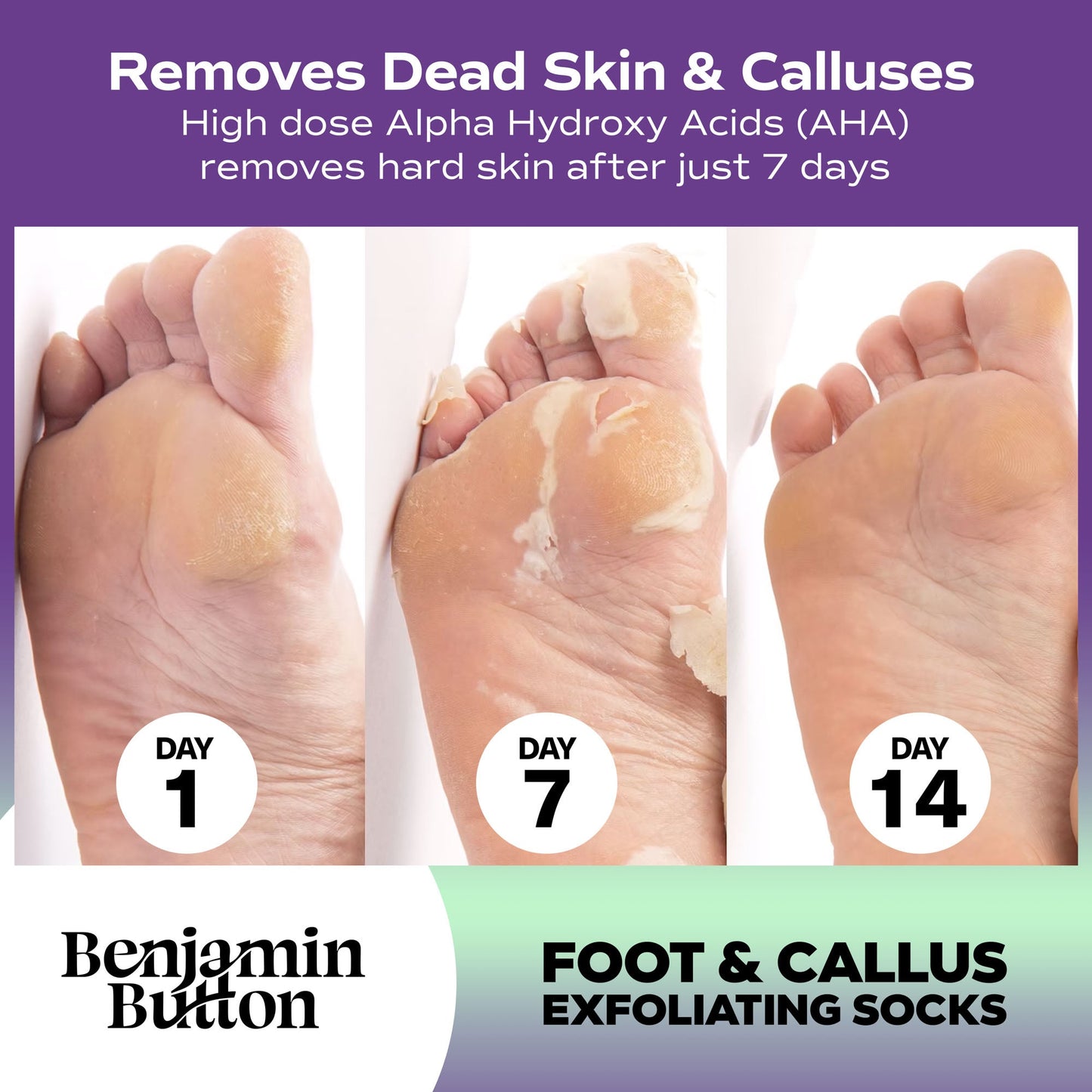Benjamin Button Advanced Exfoliating Foot Peel Mask 5 Pack
