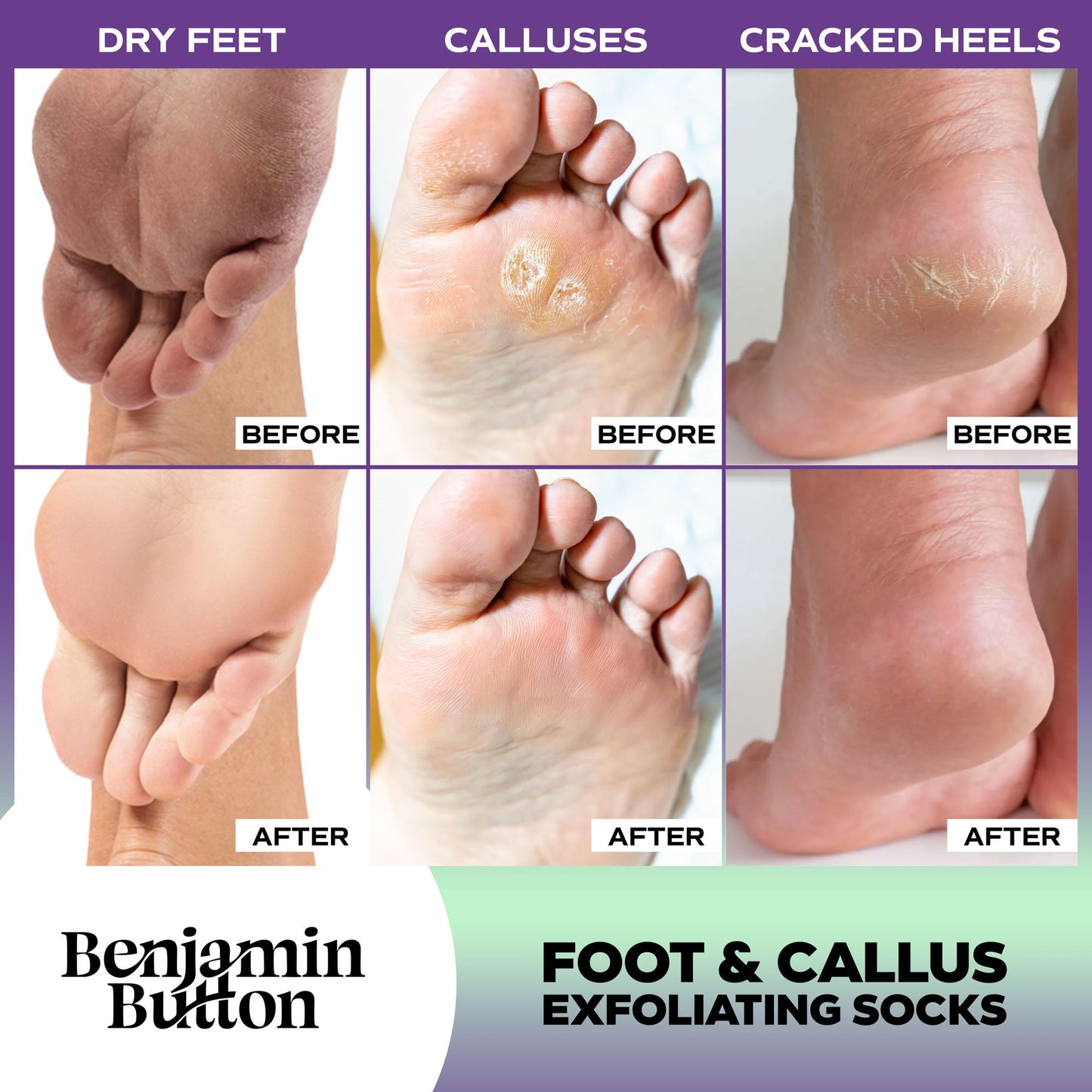 Benjamin Button Advanced Exfoliating Foot Peel Mask 5 Pack