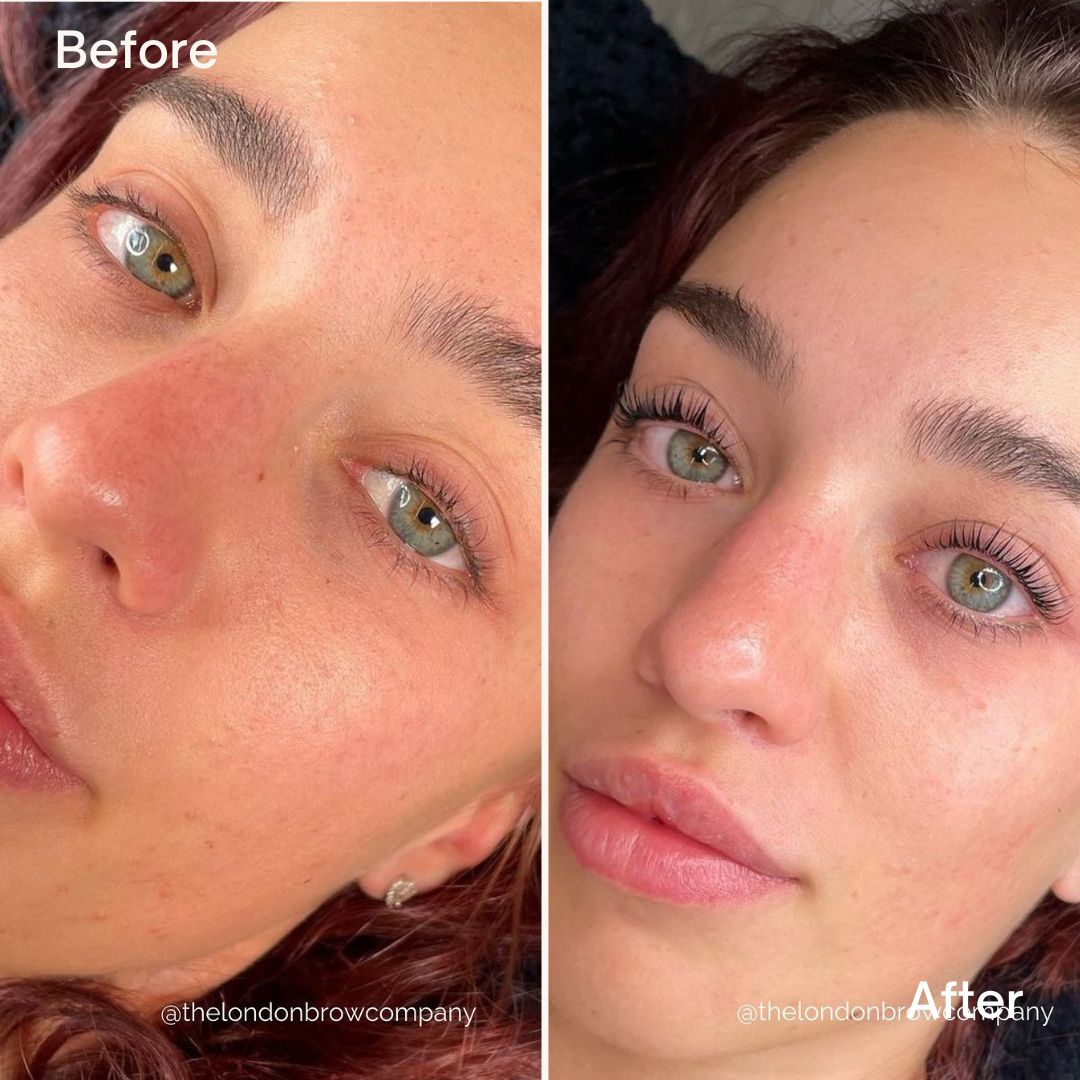 London Speed-Lift Lash Lifting System — Full Kit