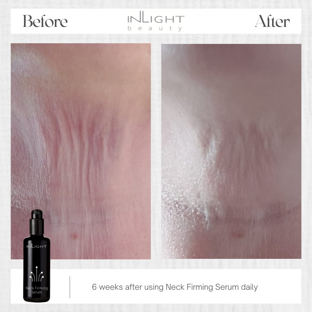 Inlight Beauty Neck Firming Serum 50ml
