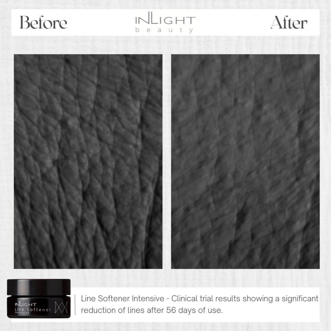 Before and after comparison of skin texture with Inlight Beauty Line Softener Intensive 15ml.