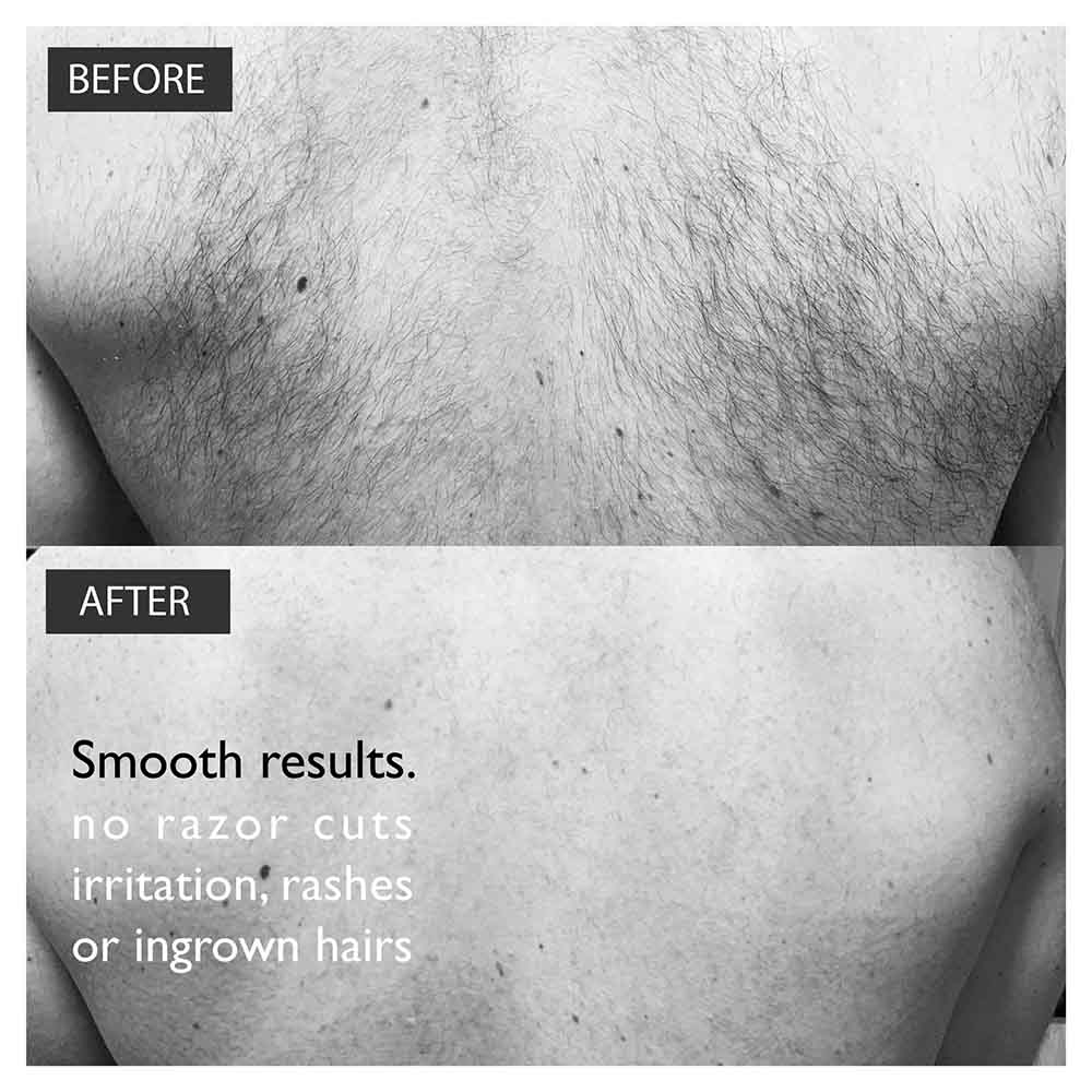 Baldape Parlour Back & Body Hair Removal - The Silverback Kit