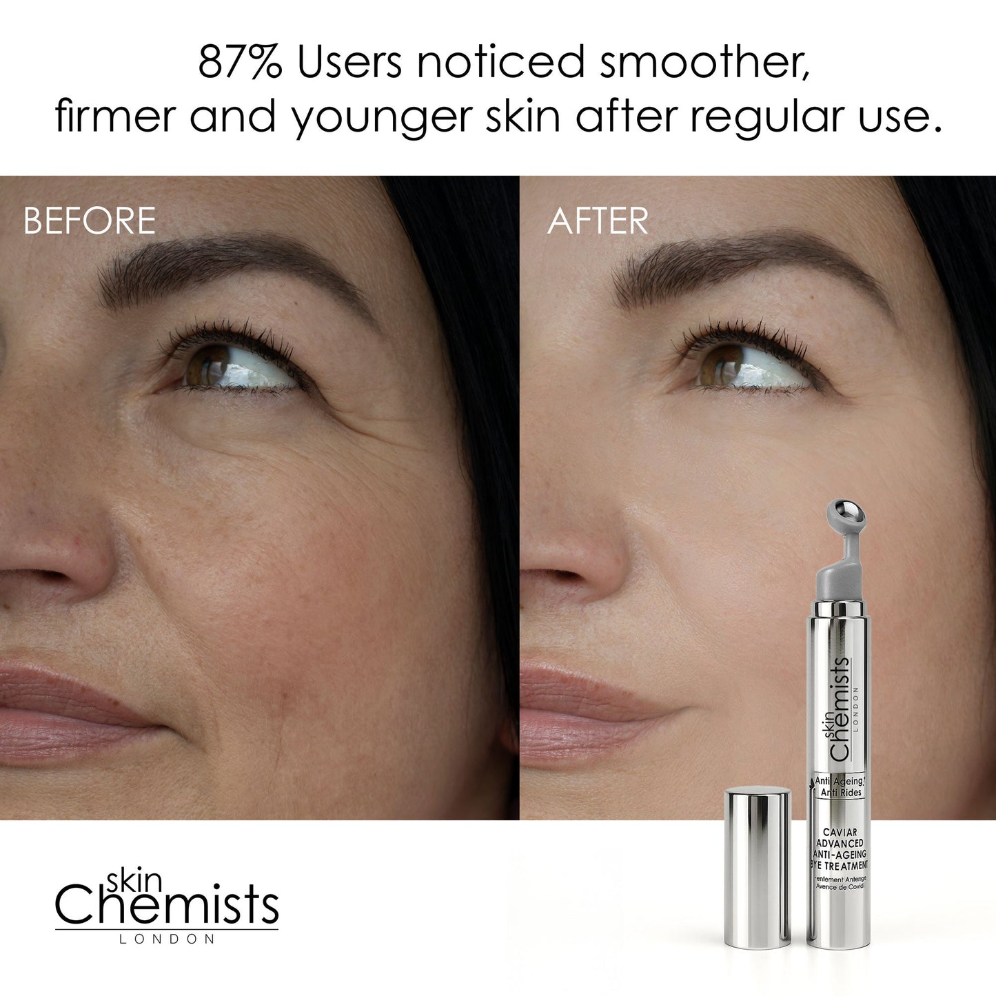 skinChemists Caviar Advanced Anti-Ageing Eye Treatment 15ml