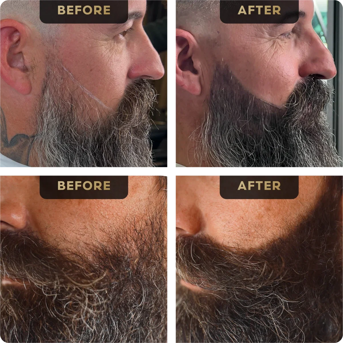 Before and after beard pen result