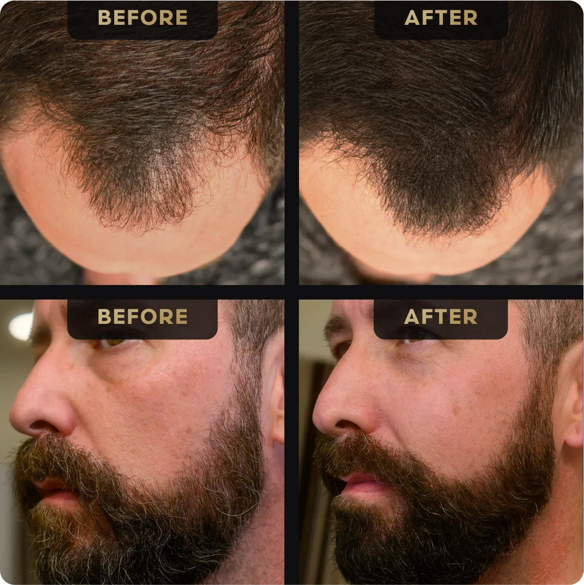 Before and after beard concealer result